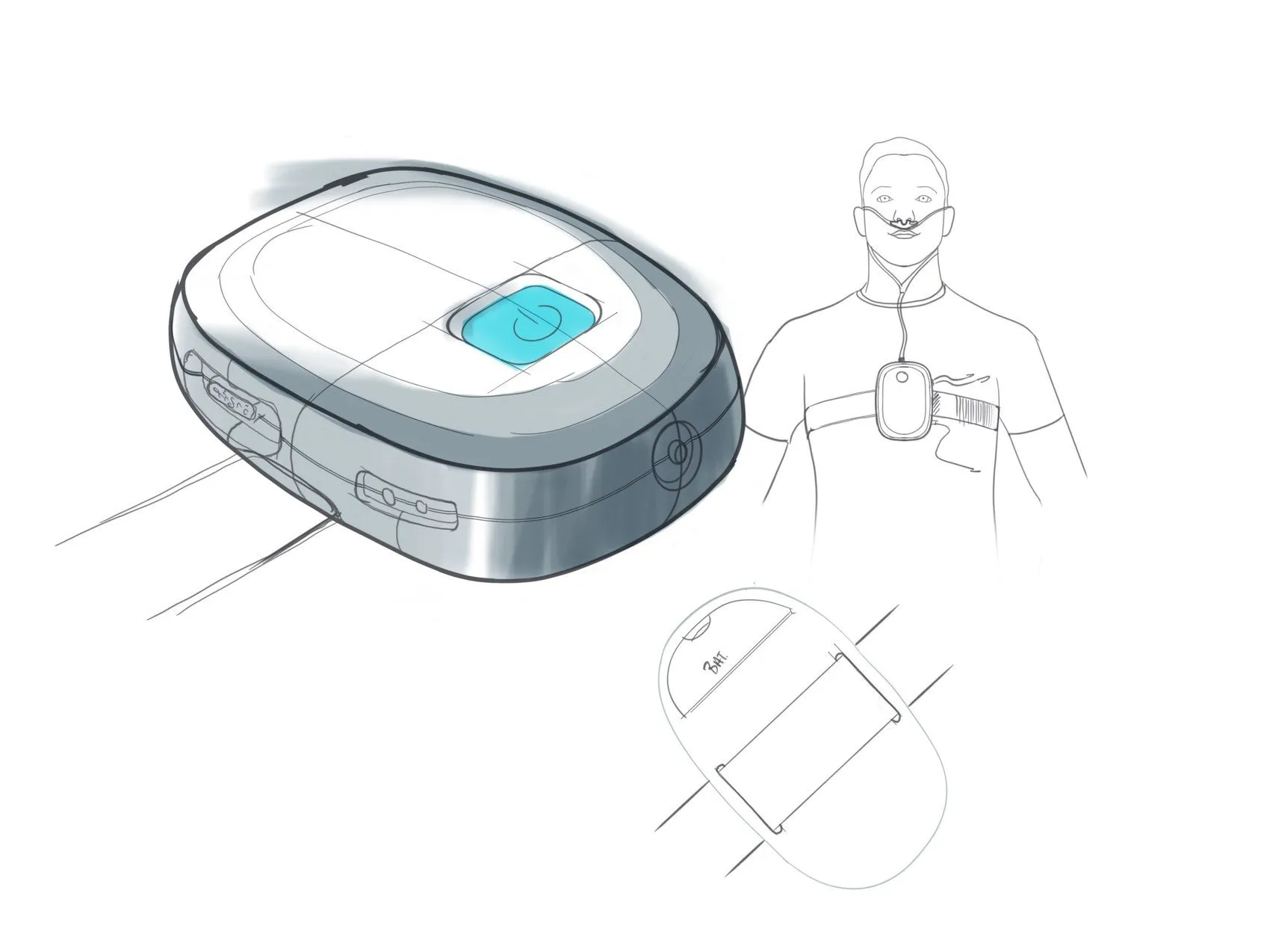 Marker concept rendering of the recorder beside a sketch of a patient wearing it on a chest belt