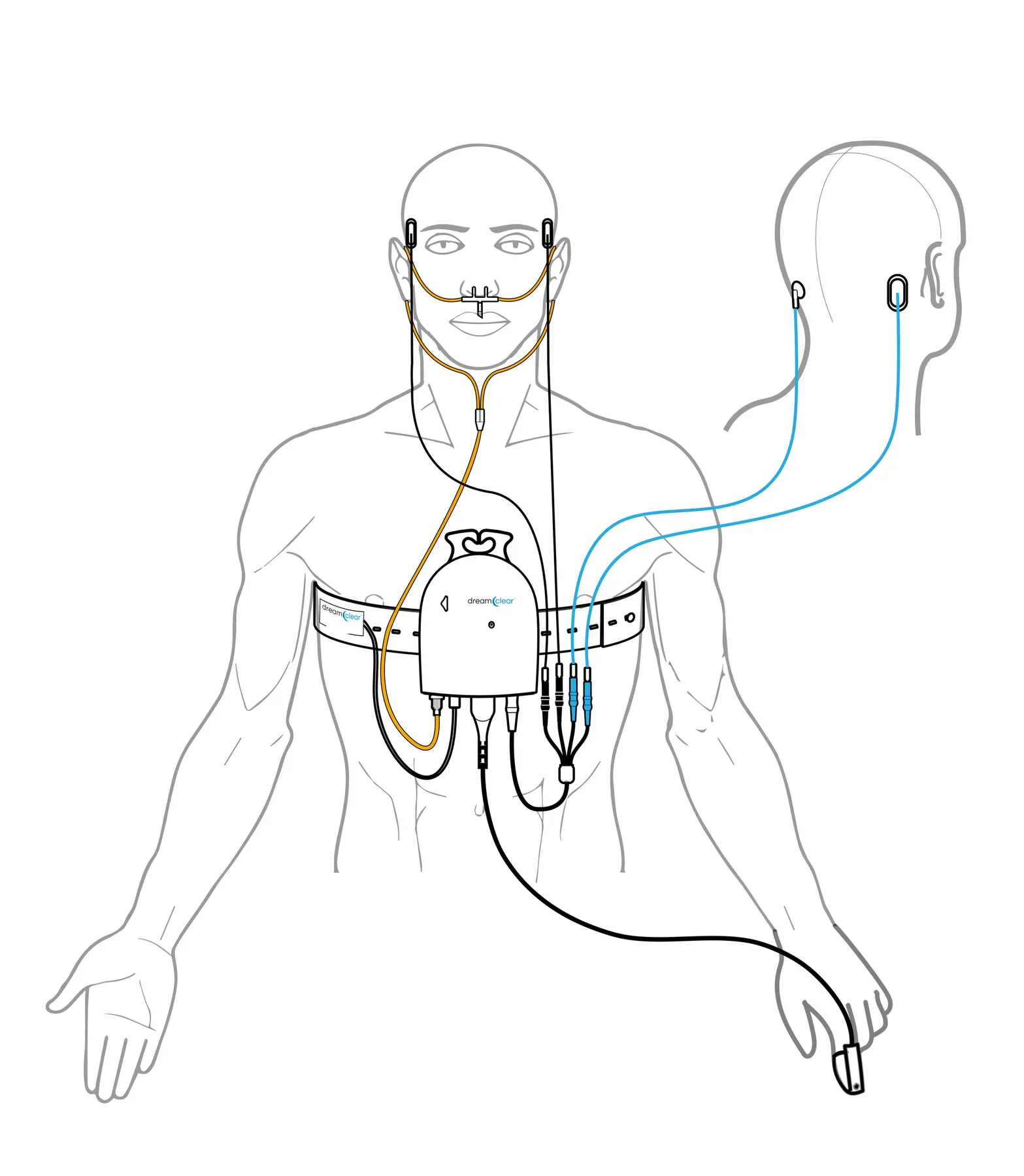 Line drawing of a patient wearing the recorder on a chest belt, connected to a nasal cannula, a finger oximeter and EEG and EOG electrodes