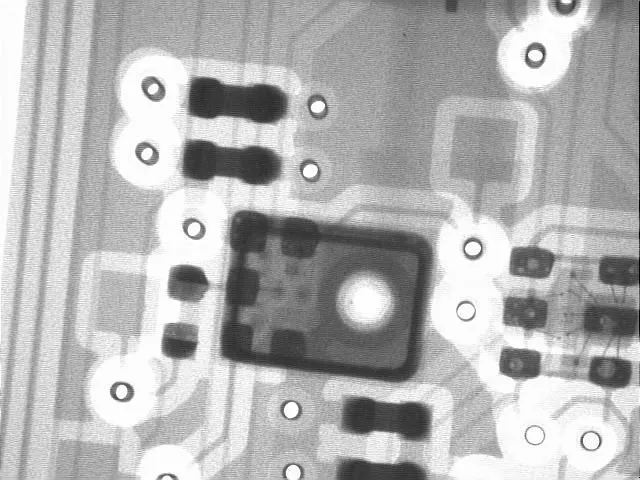 X-ray image of the snore microphone assembly on the circuit board