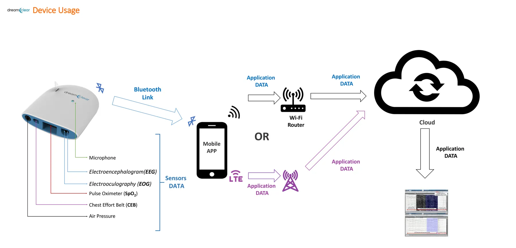 Diagram of the data path from the recorder over Bluetooth to a phone app, then over Wi-Fi or LTE to the cloud for scoring