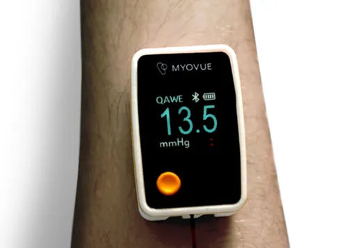 MY01 Myovue monitor strapped to a forearm displaying a pressure reading of 13.5 mmHg
