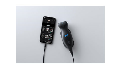 Butterfly-New-Ultrasound-Technology (1)