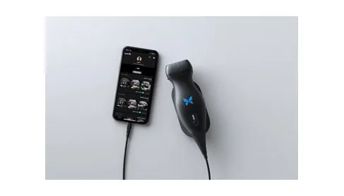 Butterfly-New-Ultrasound-Technology (1)