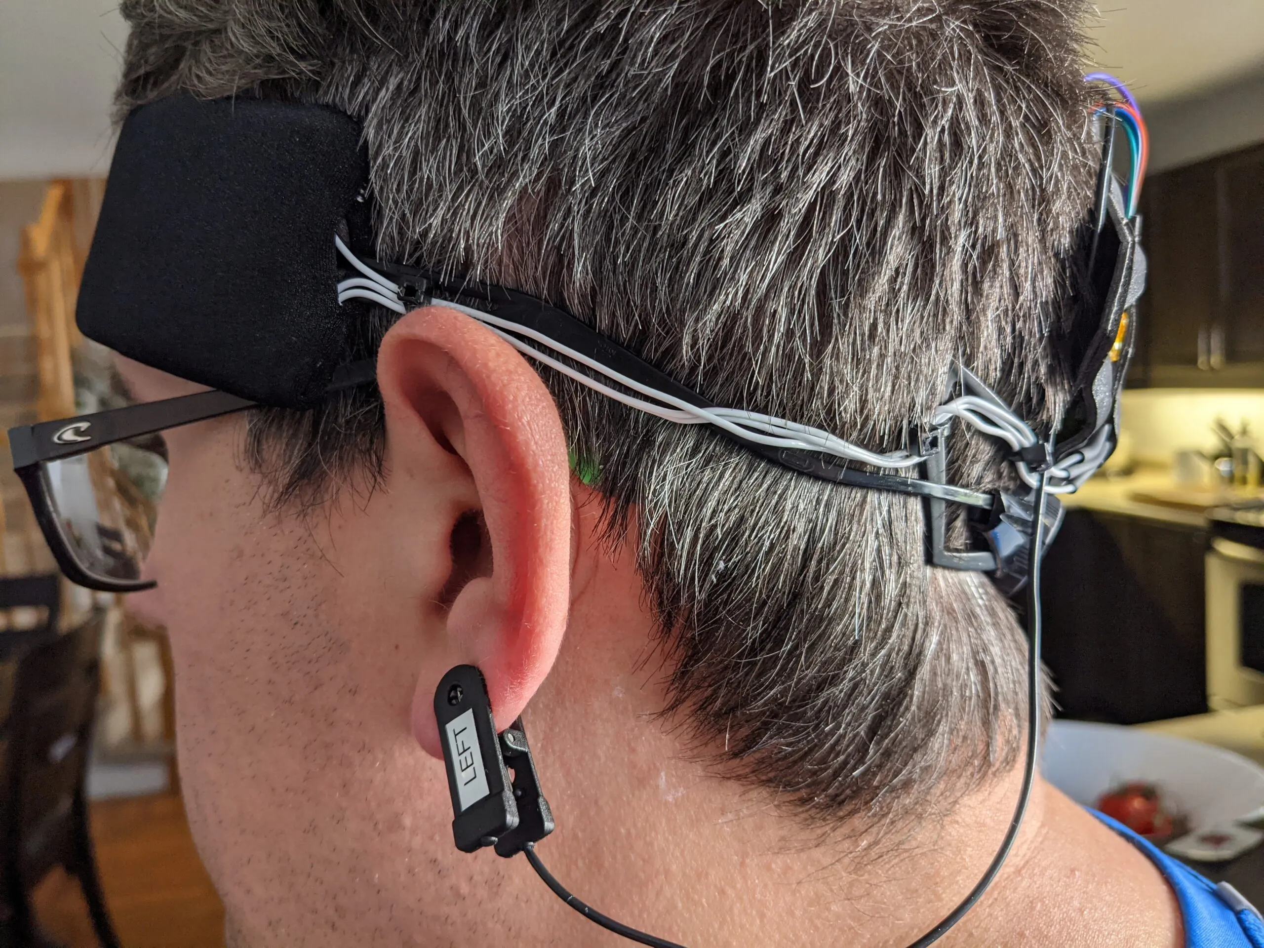 Early Neurovine prototype worn behind the ear with a clip electrode and wiring